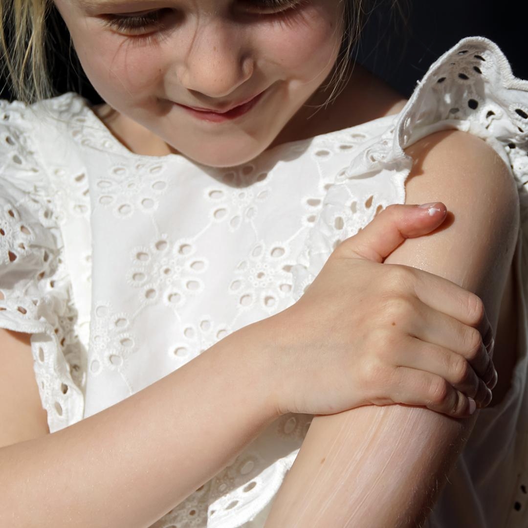 Solråd fra Derma - smør rigeligt solcreme på!