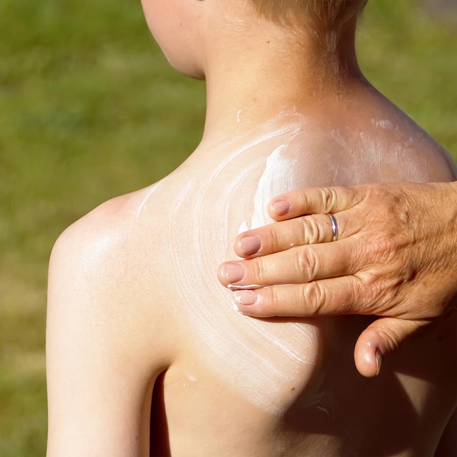 Derma - solcreme der ikke fedter